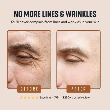 🆙Wrinkle Defense Tallow Balm✨