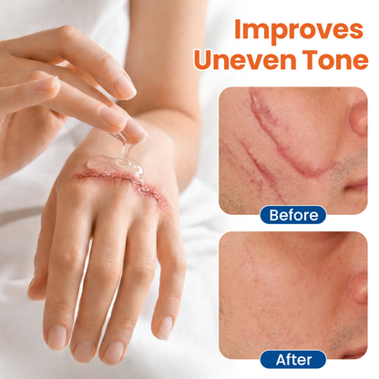 ✨💧 oliveavepolish®Professional Skin Renewal Gel For Firmer, Smoother Skin