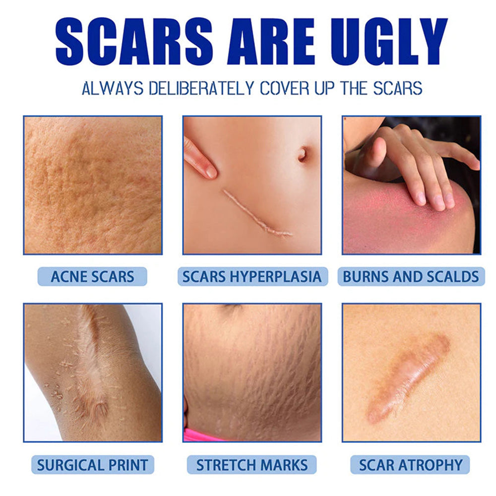 🆙🆙 oliveavepolish®  Advanced Scar Repair Cream – Fade Scars & Smooth Skin for All Skin Types