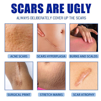 🆙🆙 oliveavepolish®  Advanced Scar Repair Cream – Fade Scars & Smooth Skin for All Skin Types