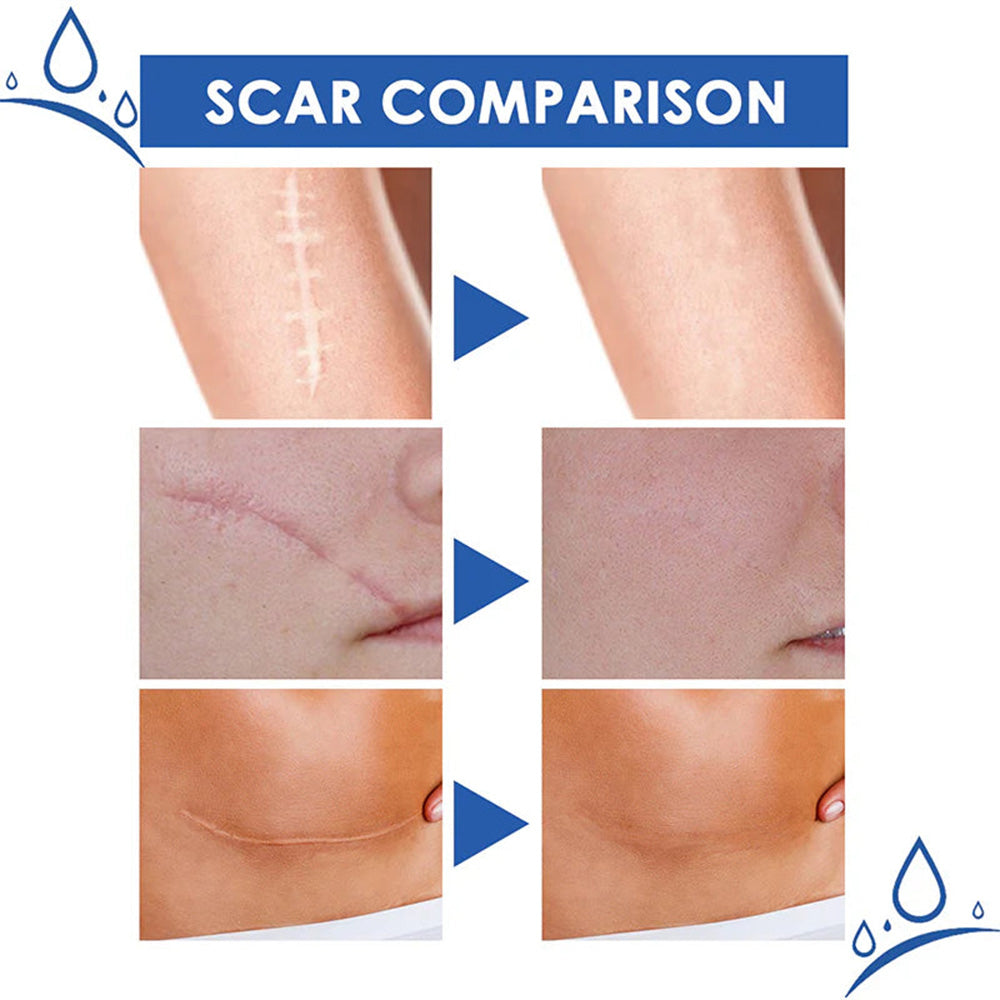 🆙🆙 oliveavepolish®  Advanced Scar Repair Cream – Fade Scars & Smooth Skin for All Skin Types