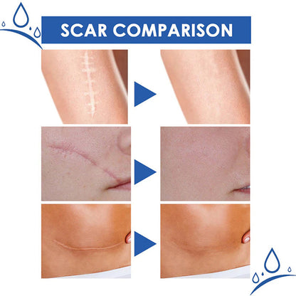 🆙🆙 oliveavepolish®  Advanced Scar Repair Cream – Fade Scars & Smooth Skin for All Skin Types